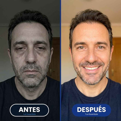 Suplemento liposomal NAD+ con resveratrol